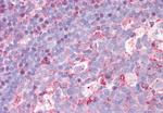 CTR1 Antibody in Immunohistochemistry (Paraffin) (IHC (P))