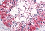 SRPX2 Antibody in Immunohistochemistry (Paraffin) (IHC (P))