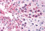 TFF2 Antibody in Immunohistochemistry (Paraffin) (IHC (P))