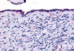 THRA Polyclonal Antibody