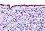 THRA Polyclonal Antibody