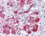 TM9SF1 Antibody in Immunohistochemistry (Paraffin) (IHC (P))