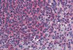 TM9SF3 Polyclonal Antibody