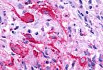 TPRA1 Antibody in Immunohistochemistry (Paraffin) (IHC (P))