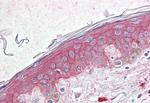 TSPAN6 Antibody in Immunohistochemistry (Paraffin) (IHC (P))