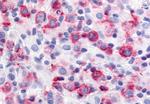 USP20 Antibody in Immunohistochemistry (Paraffin) (IHC (P))