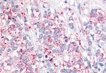 USP20 Antibody in Immunohistochemistry (Paraffin) (IHC (P))