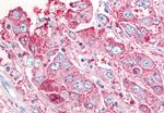 USP20 Antibody in Immunohistochemistry (Paraffin) (IHC (P))