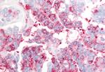 USP20 Antibody in Immunohistochemistry (Paraffin) (IHC (P))