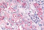 USP4 Antibody in Immunohistochemistry (Paraffin) (IHC (P))