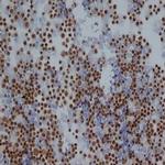 Rat IgG2b Isotype Control in Immunohistochemistry (IHC)
