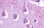 HTR5A Antibody in Immunohistochemistry (Paraffin) (IHC (P))