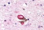 HTR7 Antibody in Immunohistochemistry (Paraffin) (IHC (P))