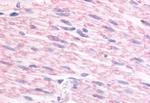 alpha-2c Adrenergic Receptor Polyclonal Antibody