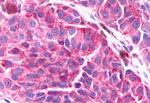 BAI3 Antibody in Immunohistochemistry (Paraffin) (IHC (P))