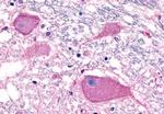 BAI3 Antibody in Immunohistochemistry (Paraffin) (IHC (P))