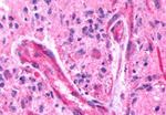 BAI3 Antibody in Immunohistochemistry (Paraffin) (IHC (P))