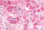 BDKRB2 Antibody in Immunohistochemistry (Paraffin) (IHC (P))