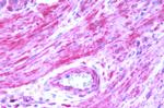 BDKRB2 Antibody in Immunohistochemistry (Paraffin) (IHC (P))