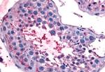 Bestrophin 2 Antibody in Immunohistochemistry (Paraffin) (IHC (P))