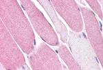 Bestrophin 3 Antibody in Immunohistochemistry (Paraffin) (IHC (P))