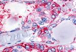 Calcitonin Receptor Polyclonal Antibody