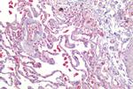 CALCRL Antibody in Immunohistochemistry (Paraffin) (IHC (P))