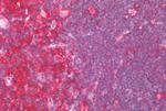 CCR6 Antibody in Immunohistochemistry (Paraffin) (IHC (P))