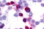 CCR7 Antibody in Immunocytochemistry (ICC/IF)