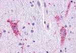 CCR9 Antibody in Immunohistochemistry (Paraffin) (IHC (P))