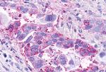 CCRL2 Antibody in Immunohistochemistry (Paraffin) (IHC (P))