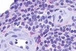 CCRL2 Antibody in Immunohistochemistry (Paraffin) (IHC (P))