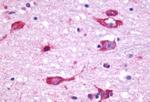CHRM5 Antibody in Immunohistochemistry (Paraffin) (IHC (P))