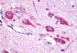 CHRM5 Antibody in Immunohistochemistry (Paraffin) (IHC (P))
