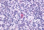 CXCR5 Antibody in Immunohistochemistry (Paraffin) (IHC (P))