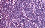CXCR5 Antibody in Immunohistochemistry (Paraffin) (IHC (P))
