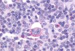 CXCR5 Antibody in Immunohistochemistry (Paraffin) (IHC (P))