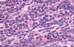 CXCR5 Antibody in Immunohistochemistry (Paraffin) (IHC (P))