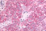 DUSP22 Antibody in Immunohistochemistry (Paraffin) (IHC (P))