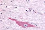 DUSP22 Antibody in Immunohistochemistry (Paraffin) (IHC (P))