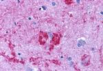 Endothelin B Receptor Antibody in Immunohistochemistry (Paraffin) (IHC (P))