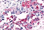 ELTD1 Antibody in Immunohistochemistry (Paraffin) (IHC (P))