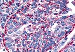 EMR3 Antibody in Immunohistochemistry (Paraffin) (IHC (P))