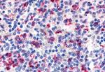EMR3 Antibody in Immunohistochemistry (Paraffin) (IHC (P))