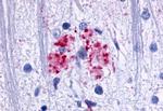 EMR3 Antibody in Immunohistochemistry (Paraffin) (IHC (P))