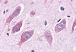 ESRRA Antibody in Immunohistochemistry (Paraffin) (IHC (P))