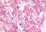 FZD6 Antibody in Immunohistochemistry (Paraffin) (IHC (P))