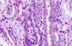 FZD8 Antibody in Immunohistochemistry (Paraffin) (IHC (P))