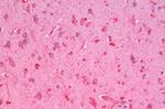 GLP1R Antibody in Immunohistochemistry (Paraffin) (IHC (P))