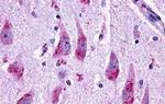 GLP2R Antibody in Immunohistochemistry (Paraffin) (IHC (P))